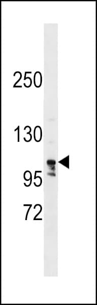 Polyclonal Rabbit anti-Human LARP1B Antibody (aa832-859, WB)