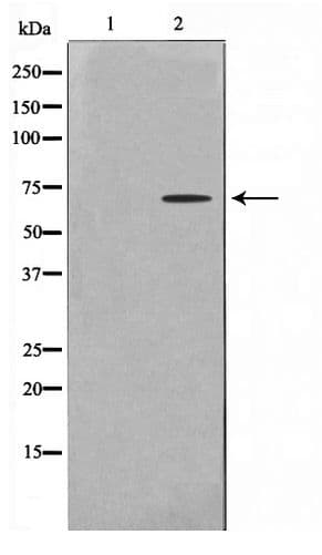 GTF2H2 Antibody