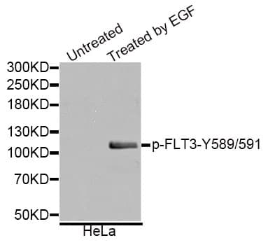CD135 / FLT3 Antibody (phospho-Tyr589/591)