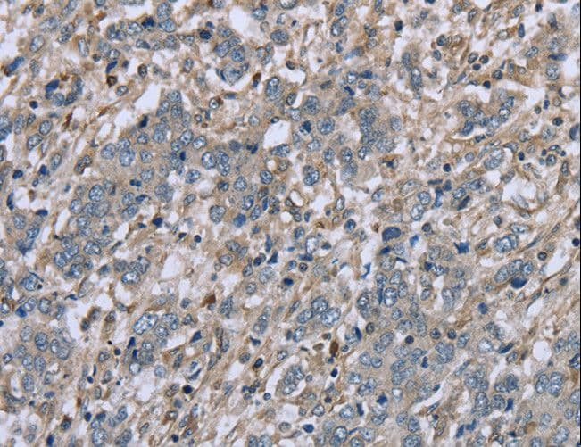 FAP Alpha Antibody