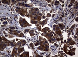 NME1 / NM23 Antibody (clone OTI24A2)