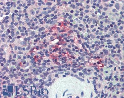 PD-L2 / PDCD1LG2 / CD273 Antibody (aa36-219)