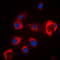 SLC39A7 / ZIP7 Antibody (Internal)