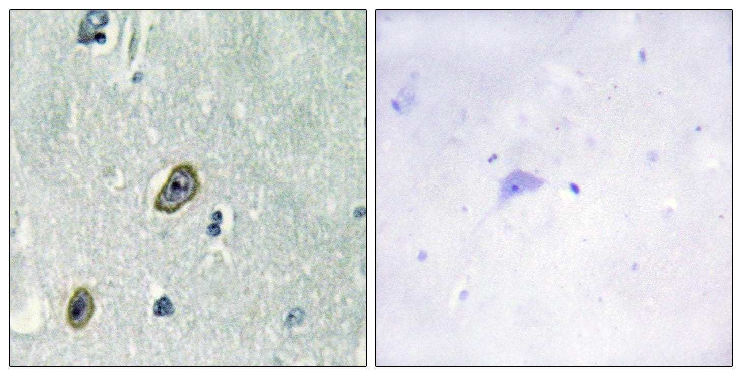 KCNIP1 / KCHIP1 Antibody