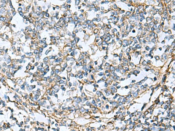 CLTB Antibody