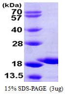 Human GSKIP / C14orf129 Protein (Recombinant His)