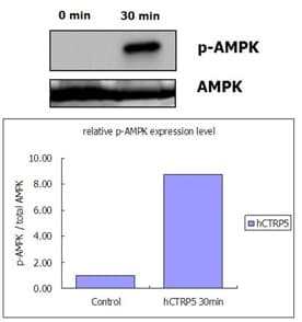 Human C1QTNF5 / CTRP5 Protein (Recombinant His)