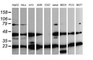 MAP2K1 / MKK1 / MEK1 Antibody (clone OTI4F1)
