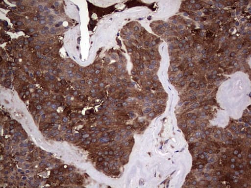 PKM2 Antibody (clone 1E7)