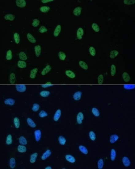 HNRNPD / AUF1 Antibody