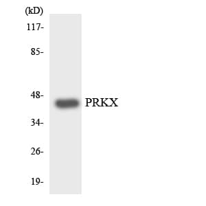 IHC-plus™ PRKX Antibody (aa249-298)
