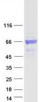 Human BTD / Biotinidase Protein (Recombinant Myc-DDK (Flag))
