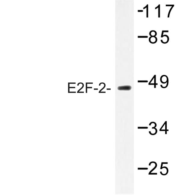 E2F2 Antibody (Lys236)