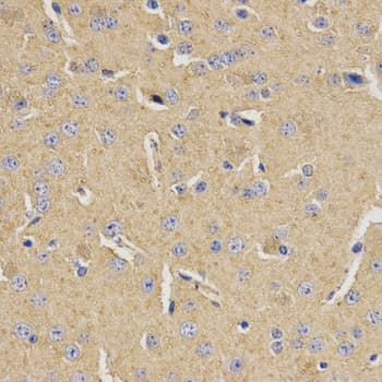 MVK Antibody