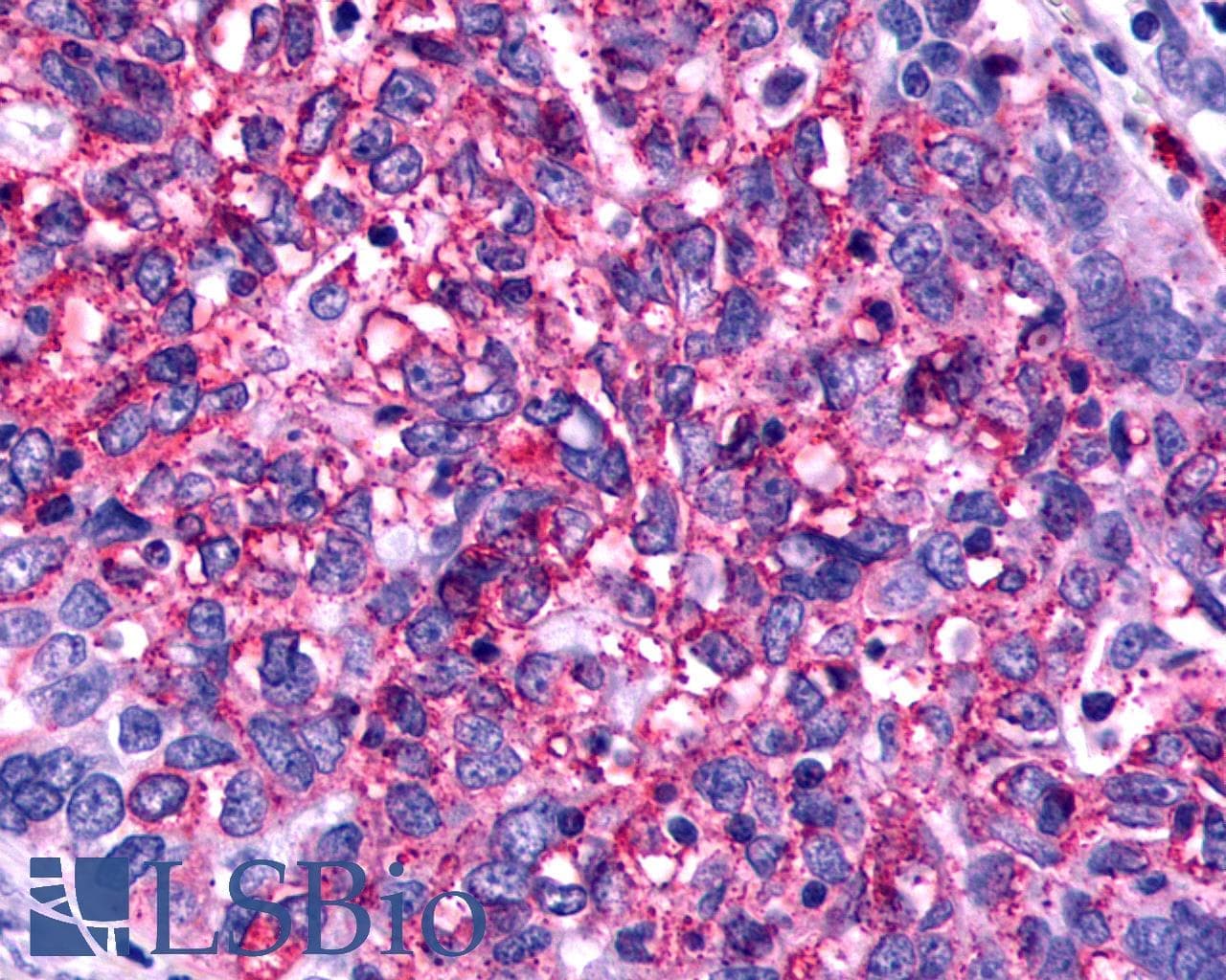 IHC-plus™ Polyclonal Rabbit anti-Human FZD2 / Frizzled 2 Antibody (N-Terminus, IHC)