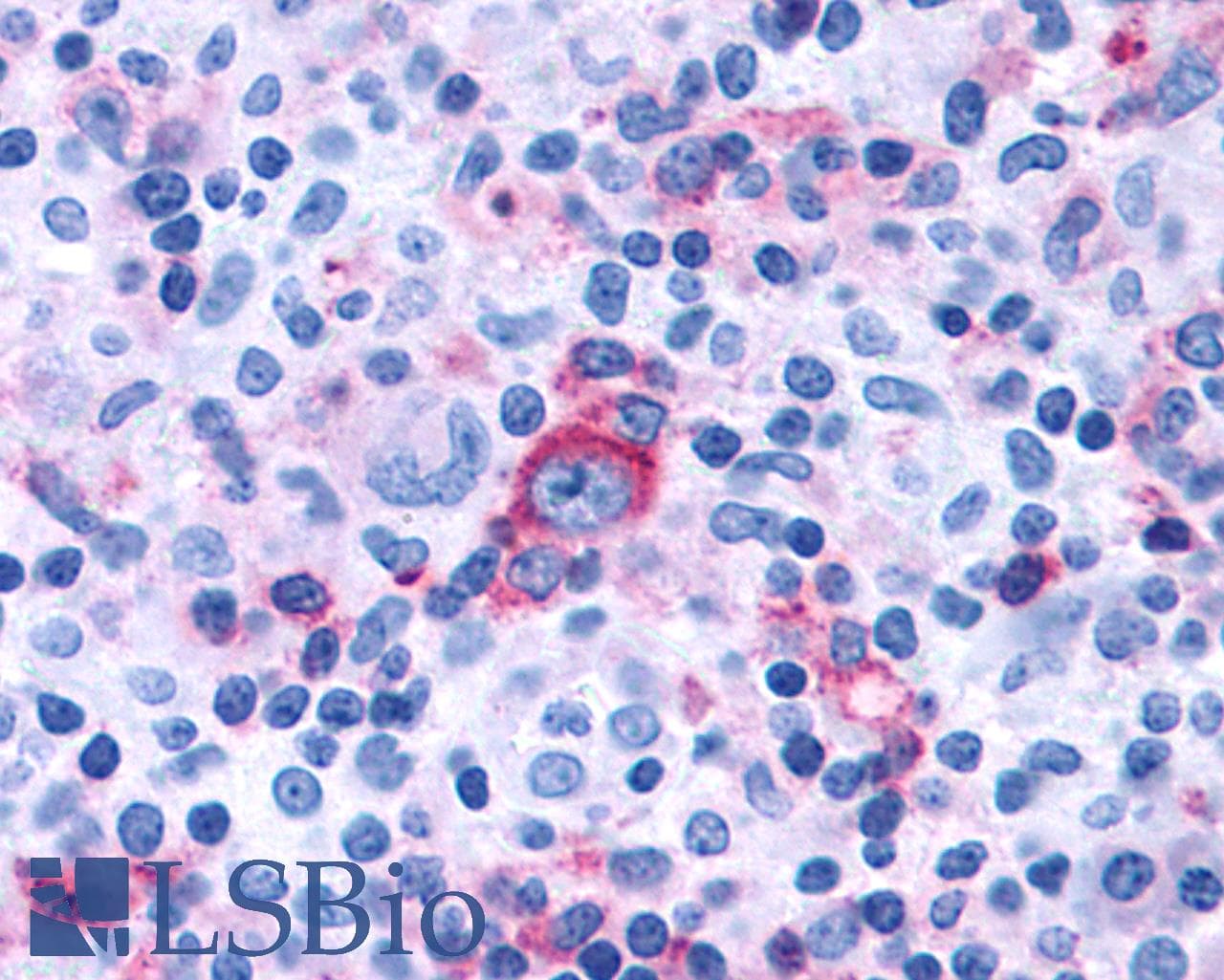 PathPlus™ ADGRG3 / GPR97 Antibody (Extracellular Domain)