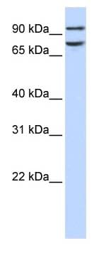FCHO1 Antibody (aa468-517)