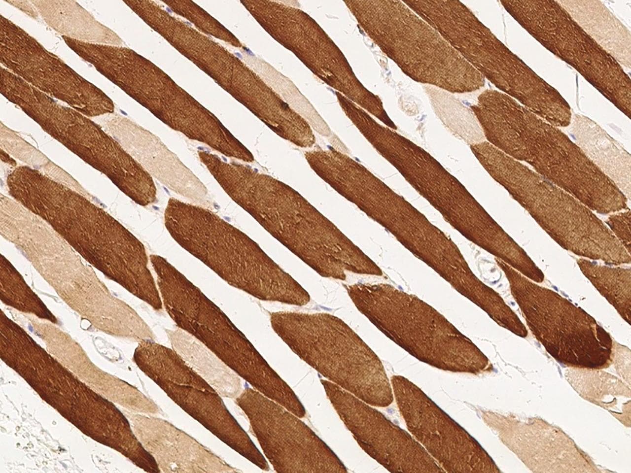 Polyclonal Rabbit anti-Mouse TNNC1 / Cardiac Troponin C Antibody (Preservative Free, IHC)
