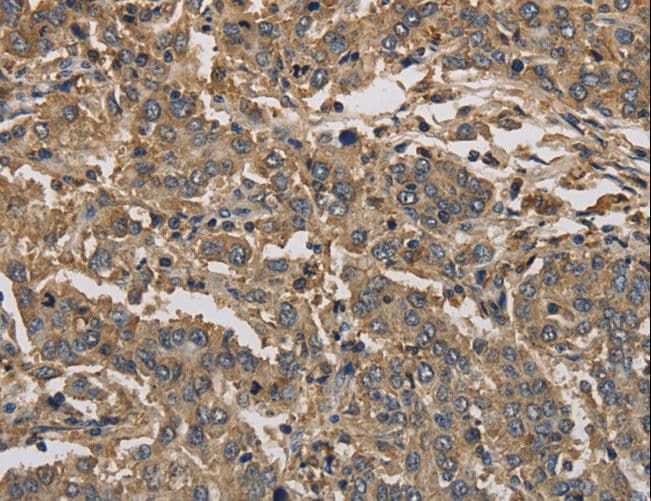 Polyclonal Rabbit anti-Human KIF22 / OBP Antibody (IHC, WB)