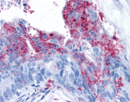 Polyclonal Rabbit anti-Human ADGRA2 / GPR124 Antibody (IHC)