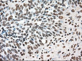 Monoclonal Mouse anti-Human TYRO3 Antibody (clone OTI2G2, IHC, WB)