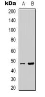 Polyclonal Rabbit anti-Human PSKH1 Antibody (Internal, IHC, WB)