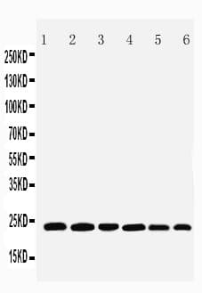 SNAP23 / SNAP-23 Antibody (aa192-211)