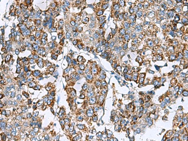 SLMO2 Antibody