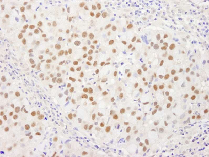 WRNIP1 / WHIP Antibody (aa400-450)