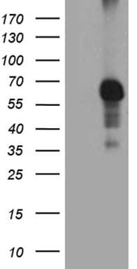 RIPK3 / RIP3 Antibody (aa233-518, clone OTI1D8)