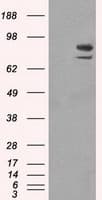 Monoclonal Mouse anti-Human SATB1 Antibody (clone OTI11E8, IHC, IF, WB)