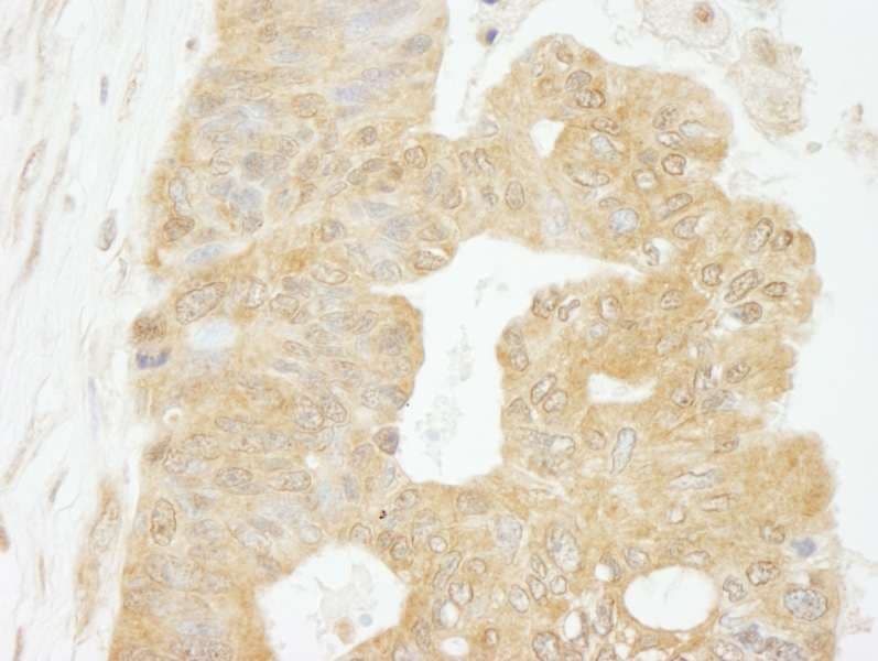 EIF4G1 / EIF4G Antibody (aa200-250)