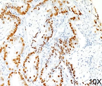 Monoclonal Mouse anti-Rat NKX2-1 / Thyroid-Specific TF Antibody (clone 8G7G3/1, Ready-to-Use, IHC)