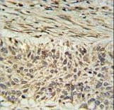 Polyclonal Rabbit anti-Human DDX23 / PRP28 Antibody (aa248-277, IHC, WB)