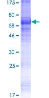 Human KCNK18 / TRESK Protein (Recombinant GST)