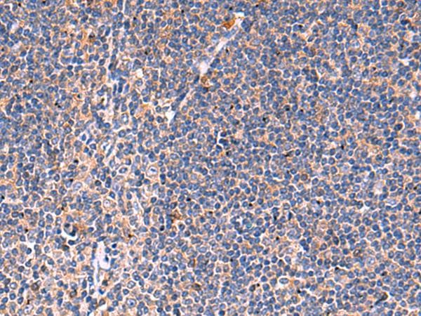 Polyclonal Rabbit anti-Human KLK9 / Kallikrein 9 Antibody (IHC)