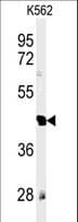 RTN4RL1 / NGRH2 Antibody (aa326-355)