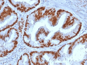 ER Alpha / Estrogen Receptor Antibody (clone ESR1/1935)
