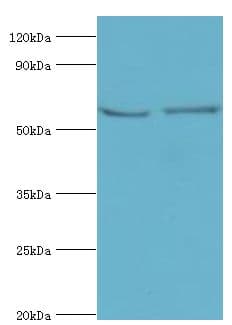 Polyclonal Rabbit anti-Human FUBP3 Antibody (aa65-260, IHC, WB)