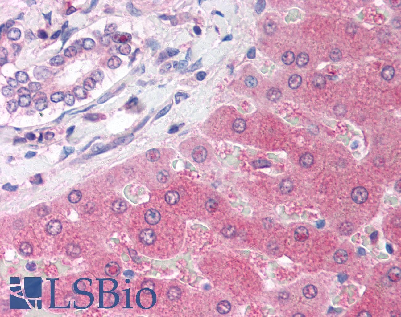 PARP2 Antibody (aa401-450)