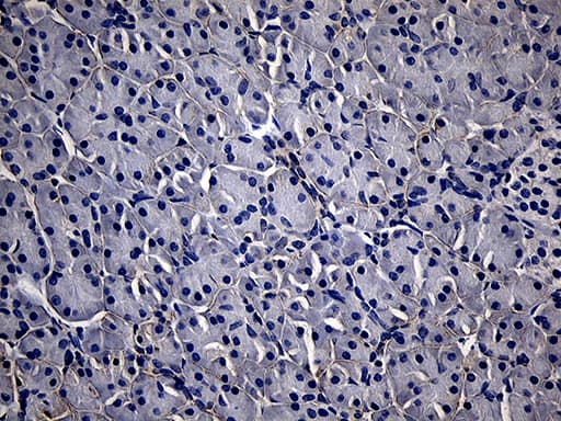 TG / Thyroglobulin Antibody (aa20-358, clone OTI8E1)