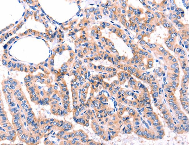 Polyclonal Rabbit anti-Human ADRBK1 / GRK2 Antibody (IHC)