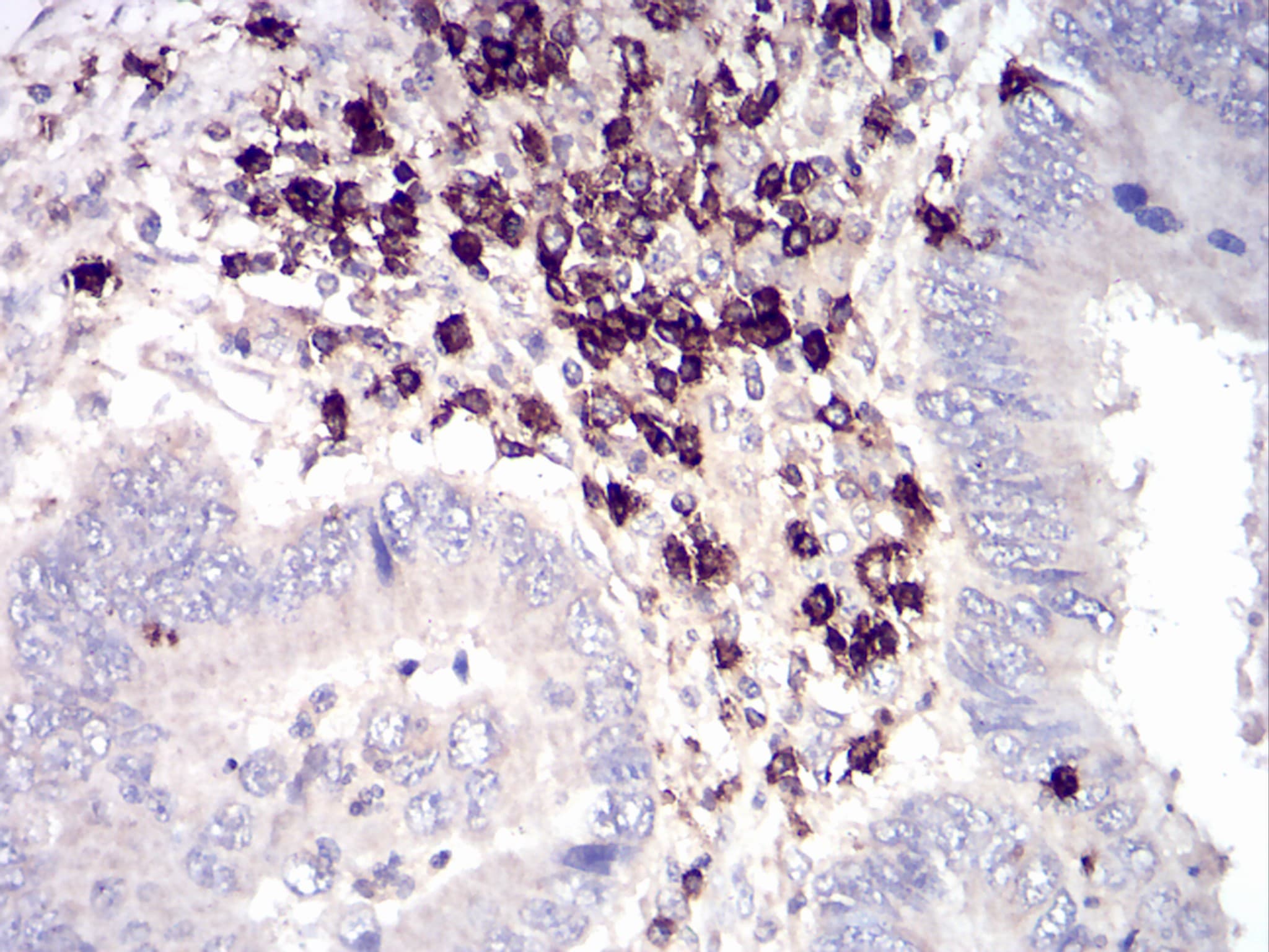 Monoclonal Mouse anti-Human CD6 Antibody (clone 5A10A2, IHC, WB)