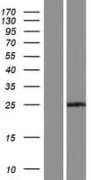MXD3 / MAD3 Protein (Over-Expression Lysate Myc-DDK (Flag))