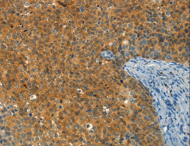 GBTS1 / DIRAS1 Antibody