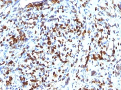 Recombinant Monoclonal Rabbit anti-Human MYOD / MYOD1 Antibody (clone MYOD1/2075R, IHC)