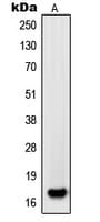 PDGF-AA Antibody (Internal)