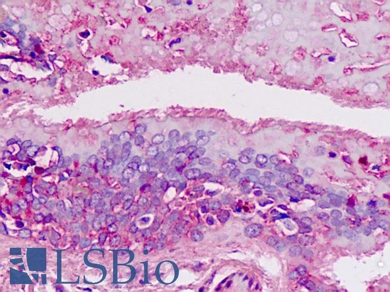 IHC-plus™ SPC18 / SEC11A Antibody (aa95-123)