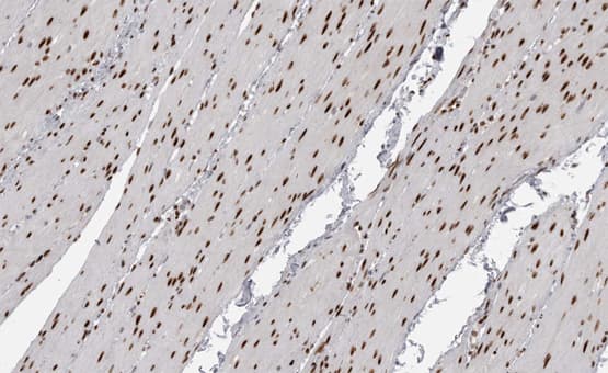 MEF2A / MEF2 Antibody (phospho-Thr319)