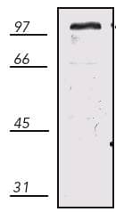 IHC-plus™ EXOC4 / SEC8 Antibody (clone 14G1)